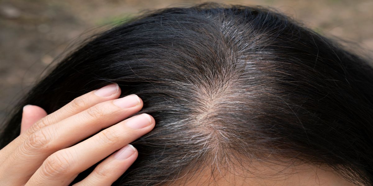 Premature Gray Hair: What are the Common Causes? - HK Vitals